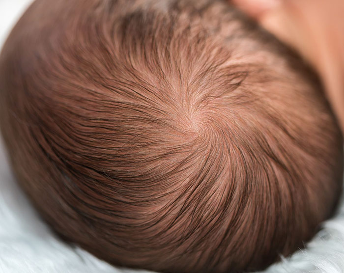 szampon na sucha skore głowy u niemowlaka