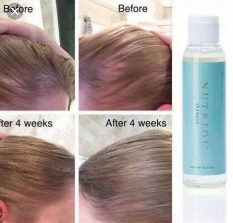 nu skin szampon na porost włosów opinie