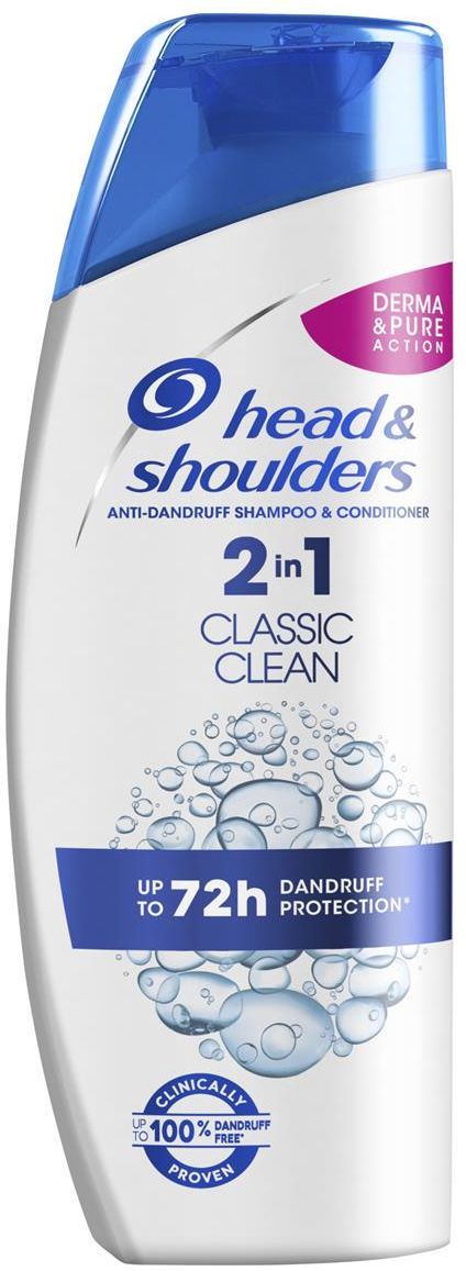 lakier do włosów head & shoulders